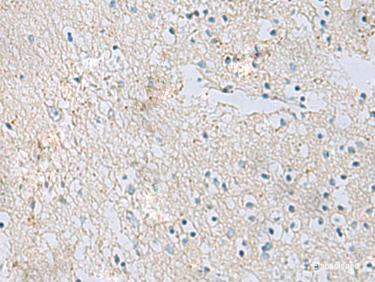 Immunohistochemistry of paraffin-embedded Human brain tissue  using RDH5 Polyclonal Antibody at dilution of 1:50(×200)