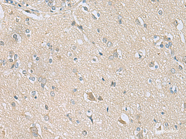 Immunohistochemistry of paraffin-embedded Human brain tissue  using TSTA3 Polyclonal Antibody at dilution of 1:80(×200)
