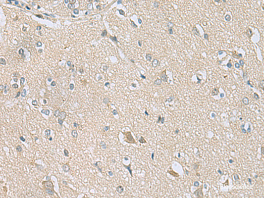 Immunohistochemistry of paraffin-embedded Human brain tissue  using TSTA3 Polyclonal Antibody at dilution of 1:80(×200)