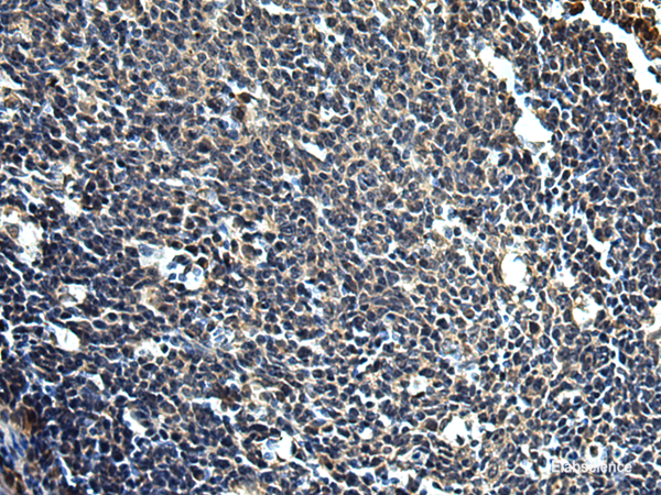 Immunohistochemistry of paraffin-embedded Human tonsil tissue  using PRRT2 Polyclonal Antibody at dilution of 1:50(×200)