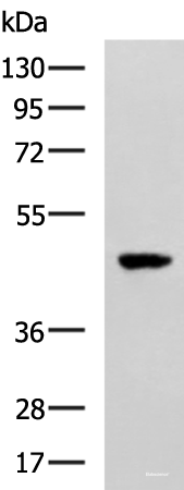 Western blot analysis of TM4 cell lysate  using SNIP1 Polyclonal Antibody at dilution of 1:1000