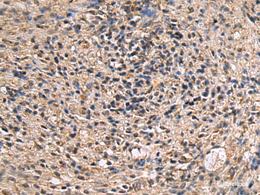 Immunohistochemistry of paraffin-embedded Human brain tissue  using ITIH2 Polyclonal Antibody at dilution of 1:70(×200)