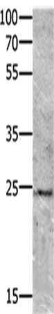 Western blot analysis of Mouse brain tissue  using VEGFB Polyclonal Antibody at dilution of 1:700