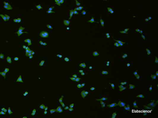 Immunofluorescence analysis of hela cell  using SLC18A3 Polyclonal Antibody at dilution of 1:50