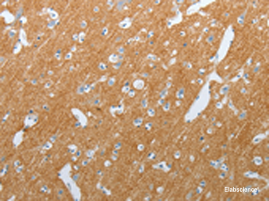 Immunohistochemistry of paraffin-embedded Human brain tissue  using SLC17A7 Polyclonal Antibody at dilution of 1:200(×200)