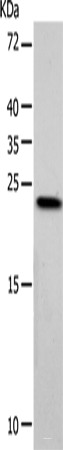 Western blot analysis of Hela cells  using VSNL1 Polyclonal Antibody at dilution of 1:900