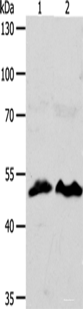 Western blot analysis of HT29 cells hela cells  using ZWILCH  Polyclonal Antibody at dilution of 1:1750