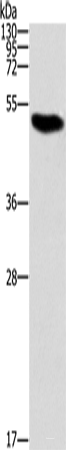 Western blot analysis of Raji cells  using ZBP1 Polyclonal Antibody at dilution of 1:1000