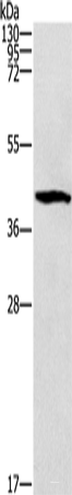 Western blot analysis of Mouse brain tissue  using ZADH2 Polyclonal Antibody at dilution of 1:1000