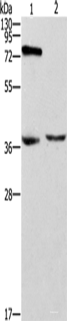 Western blot analysis of Jurkat cells mouse thymus tissue  using ZAP70  Polyclonal Antibody at dilution of 1:1000