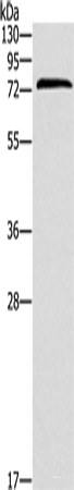 Western blot analysis of Jurkat cells  using ZAP70  Polyclonal Antibody at dilution of 1:1000