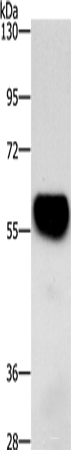 Western blot analysis of Mouse heart tissue  using ZBTB26  Polyclonal Antibody at dilution of 1:500