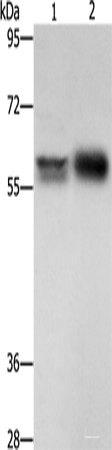 Western blot analysis of Hepg2 cells NIH/3T3 cells  using ZBTB7A  Polyclonal Antibody at dilution of 1:500