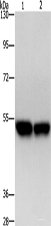 Western blot analysis of Hela cells A431 cells  using ZFYVE19  Polyclonal Antibody at dilution of 1:500