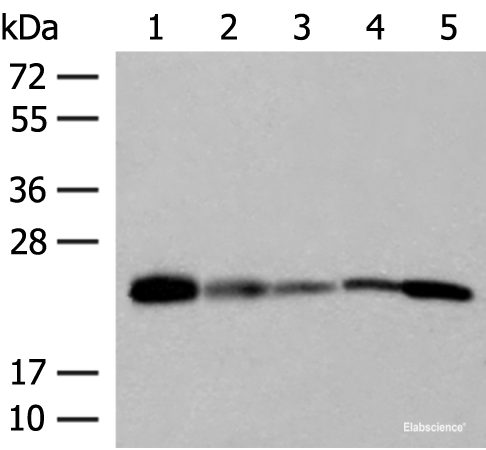 Western blot analysis of 293T 231 HUVEC Hela and A549 cell lysates  using MT-CO2 Polyclonal Antibody at dilution of 1:400