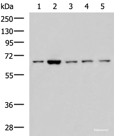 Western blot analysis of 293T LOVO Hela and Jurkat cell lysates  using CHEK2 Polyclonal Antibody at dilution of 1:600