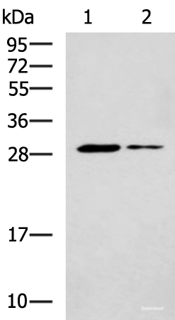Western blot analysis of Mouse liver tissue and Mouse skeletal muscle tissue lysates  using POMC Polyclonal Antibody at dilution of 1:800