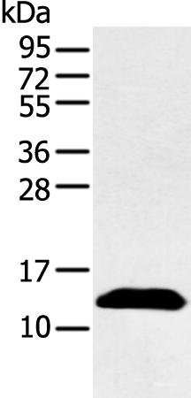 Western blot analysis of Human plasma solution  using PPBP Polyclonal Antibody at dilution of 1:500
