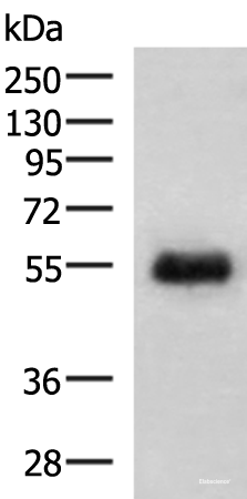 Western blot analysis of Human placenta tissue lysate  using GFRA2 Polyclonal Antibody at dilution of 1:400