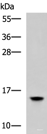 Western blot analysis of Human hepatocellular carcinoma 2 tissue lysate  using HMGA2 Polyclonal Antibody at dilution of 1:800