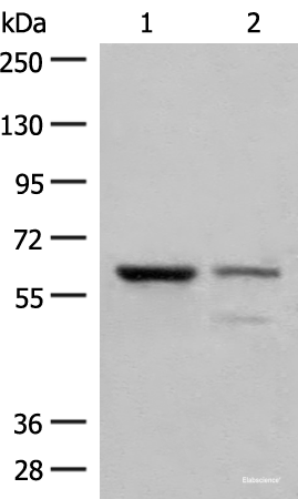 Western blot analysis of Human left kidney cancer tissue and HEPG2 cell lysates  using HNF1A Polyclonal Antibody at dilution of 1:200