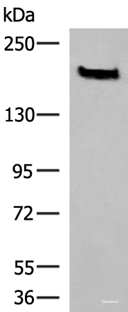 Western blot analysis of Human cerebrum tissue lysate  using NCAN Polyclonal Antibody at dilution of 1:650