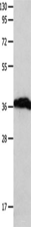 Western blot analysis of Human brain malignant glioma tissue  using P2RY6 Polyclonal Antibody at dilution of 1:550
