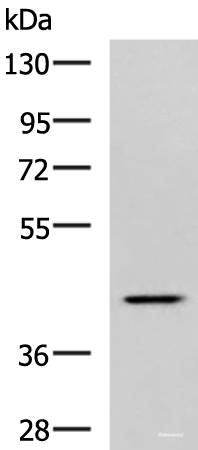 Western blot analysis of Hela cell lysate  using SYT2 Polyclonal Antibody at dilution of 1:800