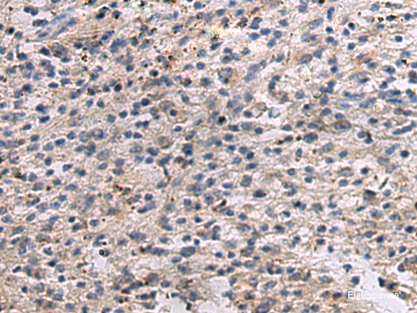 Immunohistochemistry of paraffin-embedded Human brain tissue  using ANGPTL2 Polyclonal Antibody at dilution of 1:55(×200)