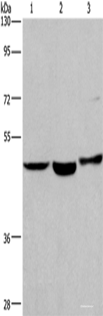 Western blot analysis of Human placenta tissue Human fetal liver tissue 231 cells  using APMAP Polyclonal Antibody at dilution of 1:400