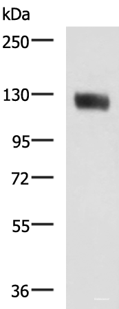 Western blot analysis of Human leiomyosarcoma tissue lysate  using MCAM Polyclonal Antibody at dilution of 1:400