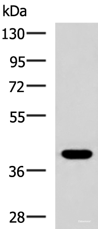 Western blot analysis of HepG2 cell lysate  using PLPPR5 Polyclonal Antibody at dilution of 1:1500