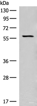 Western blot analysis of Mouse eye tissue lysate  using SLC5A1 Polyclonal Antibody at dilution of 1:350