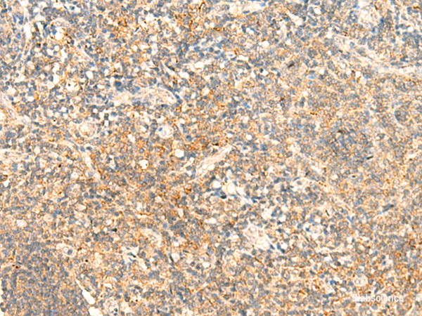 Immunohistochemistry of paraffin-embedded Human tonsil tissue  using CD93 Polyclonal Antibody at dilution of 1:50(×200)