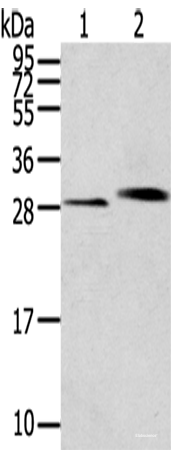 Western blot analysis of Human normal kidney tissue Human liver tissue  using CLIC4 Polyclonal Antibody at dilution of 1:200