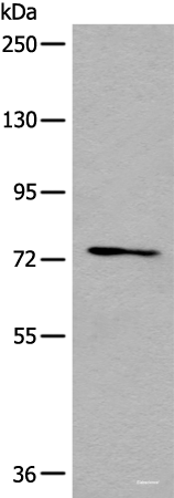 Western blot analysis of 293T cell lysate  using NFKBIZ Polyclonal Antibody at dilution of 1:500
