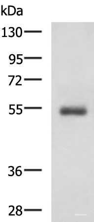 Western blot analysis of Human 2-3 grade invasive ductal breast tissue lysate  using RHCG Polyclonal Antibody at dilution of 1:600