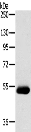 Western blot analysis of Human breast infiltrative duct tissue  using SERINC4 Polyclonal Antibody at dilution of 1:200