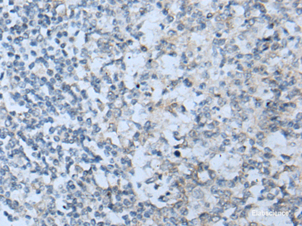 Immunohistochemistry of paraffin-embedded Human tonsil tissue  using STARD4 Polyclonal Antibody at dilution of 1:50(×200)