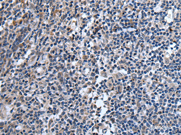 Immunohistochemistry of paraffin-embedded Human tonsil tissue  using TNFSF18 Polyclonal Antibody at dilution of 1:45(×200)