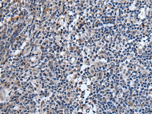 Immunohistochemistry of paraffin-embedded Human tonsil tissue  using TNFSF18 Polyclonal Antibody at dilution of 1:45(×200)