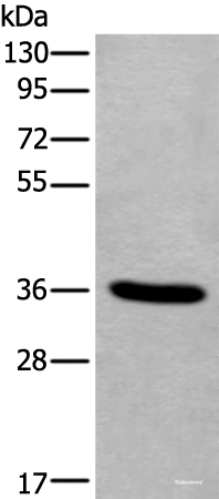 Western blot analysis of Human fetal liver tissue lysate  using TNMD Polyclonal Antibody at dilution of 1:400