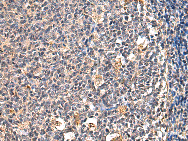 Immunohistochemistry of paraffin-embedded Human tonsil tissue  using ENTPD1 Polyclonal Antibody at dilution of 1:60(×200)