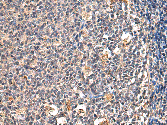 Immunohistochemistry of paraffin-embedded Human tonsil tissue  using ENTPD1 Polyclonal Antibody at dilution of 1:60(×200)