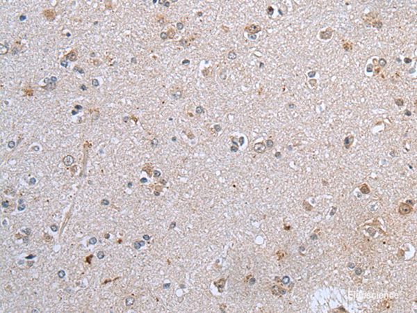 Immunohistochemistry of paraffin-embedded Human brain tissue  using CLDN12 Polyclonal Antibody at dilution of 1:45(×200)