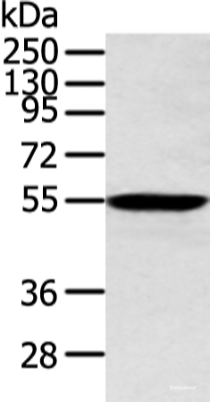 Western blot analysis of Human lung cancer tissue  using ALDH2 Polyclonal Antibody at dilution of 1:300