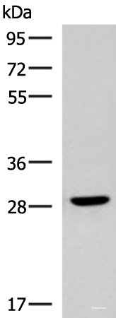 Western blot analysis of Human fetal brain tissue lysate  using CLEC9A Polyclonal Antibody at dilution of 1:800