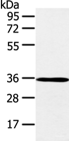 Western blot analysis of K562 cell and mouse brain tissue  using E2F5 Polyclonal Antibody at dilution of 1:400