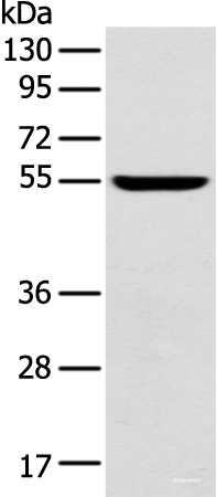 Western blot analysis of Mouse brain tissue  using FOXG1  Polyclonal Antibody at dilution of 1:550