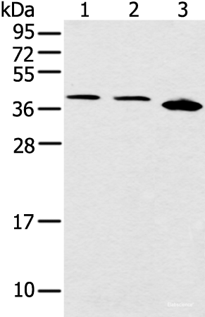 Western blot analysis of Jurkat Hela and 231 cell  using CCNG1 Polyclonal Antibody at dilution of 1:400